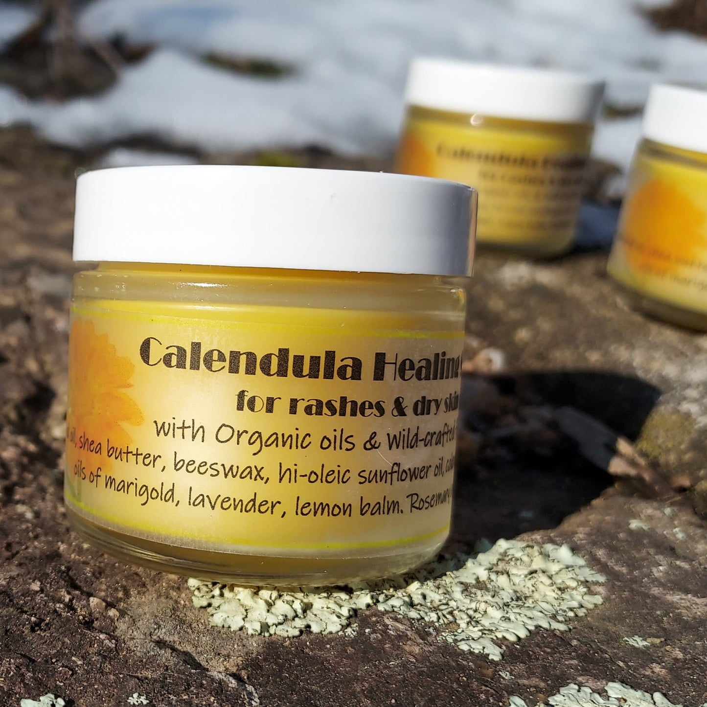 Calendula Salve for Rashes and Dry Skin