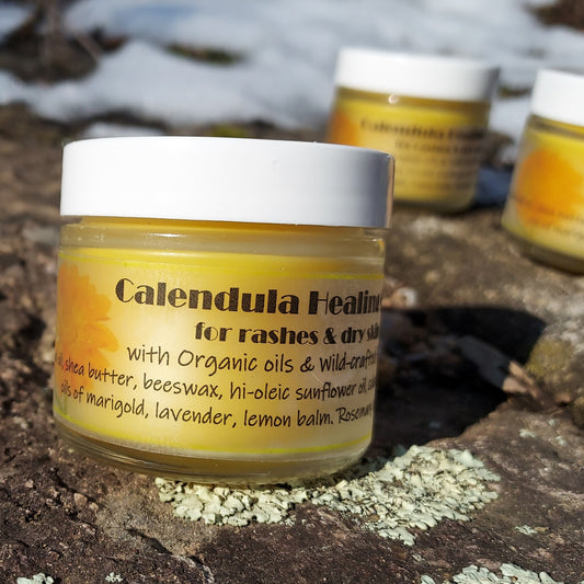 Calendula Salve for Rashes and Dry Skin